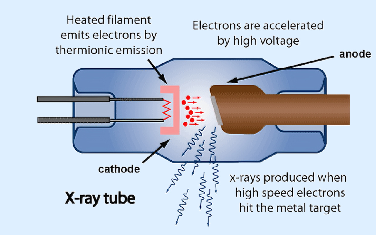2. What X-ray Technology Actually Does 2. O que a tecnologia de raios X realmente faz