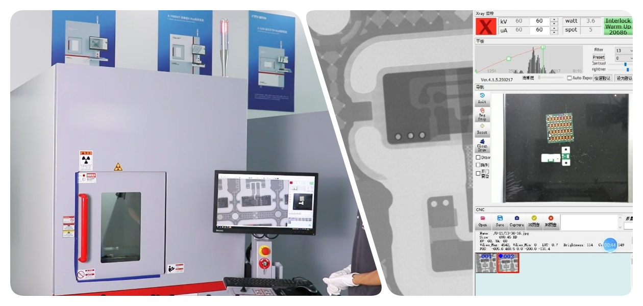 SMT Recursos de raio X (4)